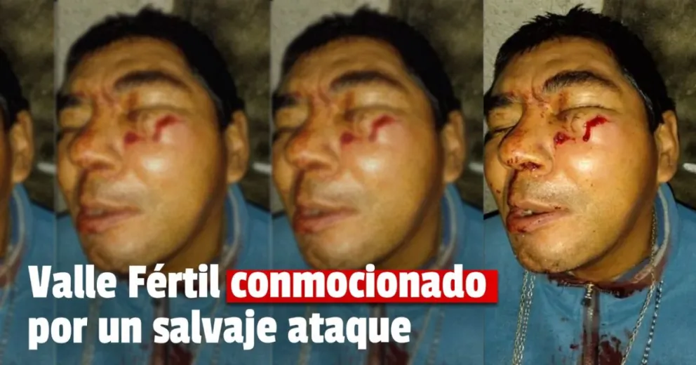 Violencia sin límites contra un hombre con discapacidad