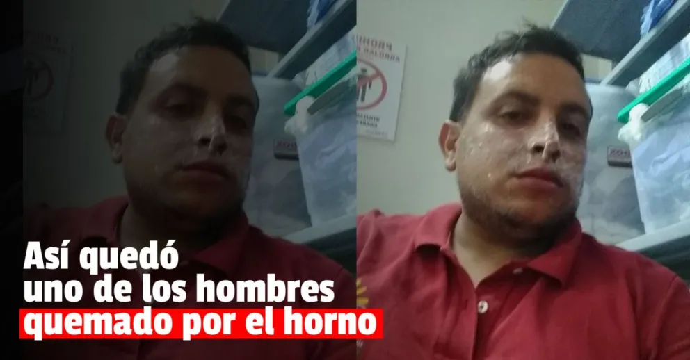 La explosión del horno fue en el Sindicato de Empleados de Comercio