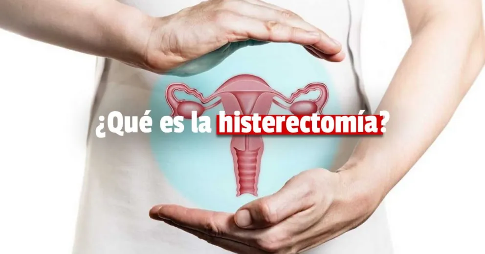 Una especialista sanjuanina explicó que es la histerectomía, la cirugía que le realizaron a Cristina Fernández