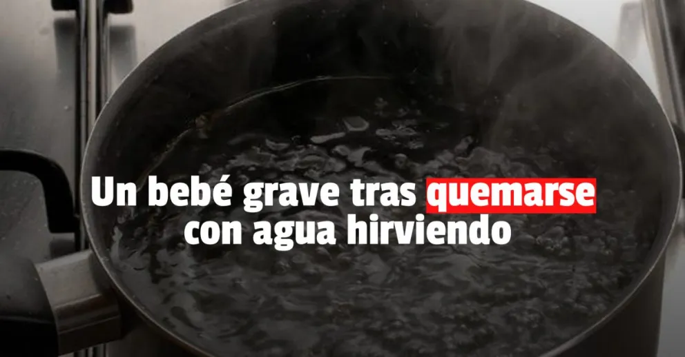 Un bebé se quemó con agua hirviendo y terminó internado